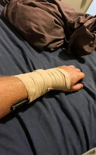 Cook Island Injury